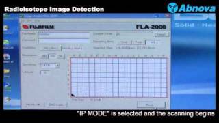 Radioisotope Image Detection [upl. by Bernadina570]