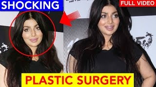 Ayesha Takia SHOCKING TRANSFORMATION after Plastic Surgery  Ayesha Takia COPIES Kylie Jenner Video [upl. by Atsahc]