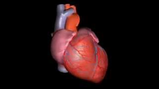 Ventricular TachycardiaVentricular Fibrillation and ICDImplantable Cardioverter Defibrillator [upl. by Annanhoj]