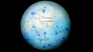 Práctica de observación de bacterias saprofitas Observation of a buccal smear saprophytic bacteria [upl. by Lisette]