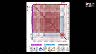 Trends in Neuroimaging Analysis Virtual Talk at the University of Connecticut [upl. by Nonie]