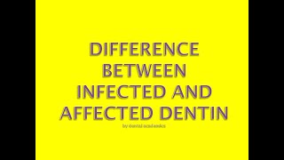 Difference between infected and affected dentin [upl. by Britton]