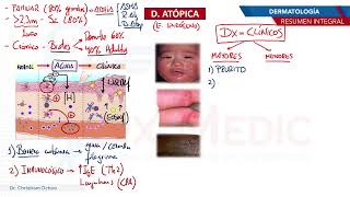 Dermatología  Dermatitis atopica [upl. by Swithbart]