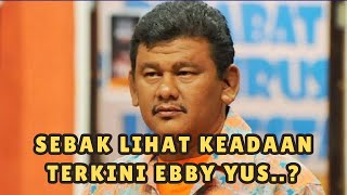 Ramai tak tahan sebak lihat keadaan terkini Ebby Yus [upl. by Vandyke]