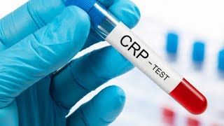 CRP  CReactive proteincrp test procedurewhat does c mean in crpdrnajeebviralhealthscience [upl. by Samale]