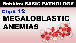 Ch12  Megaloblastic Anemias  Pernicious Anemia  Blood Pathology  Dr Asif Lectures [upl. by Ava]