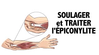 Soulager et traiter l’épicondylite [upl. by Aynwat]