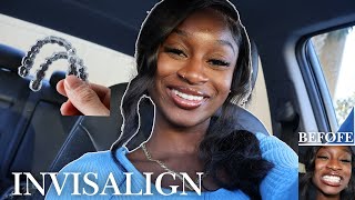 Vlog My Invisalign Journey First Day wAligners Adaesha Ayanna [upl. by Lauder]