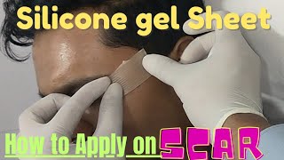 How to use silicone gel sheet for scar treatment How to apply silicone gel sheet on scar silicone [upl. by Eemaj42]