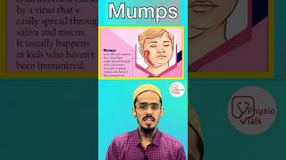 Mumps disease क्या होती है  इसका इलाज कैसे किया जाता है  shorts mumps trendingshorts [upl. by Meisel]