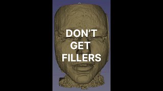 Dont Get Fillers [upl. by Mcafee298]