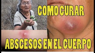 Como CURAR ABSCESOS EN EL CUERPO con Barbasco cubé  SECRETOS DE LA ABUELITA  remedio casero [upl. by Hebrew]