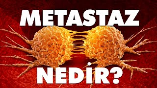 Metastaz Nedir [upl. by Gnuy117]