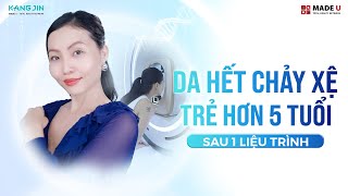 VỀ NƯỚC LÀM ĐẸP CÓ CƠ HỘI NHẬN VÉ MÁY BAY LÊN ĐẾN 1000 [upl. by Inobe]