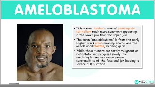 Ameloblastoma Types Clinical Features Diagnosis Differentials and Management [upl. by Giefer]