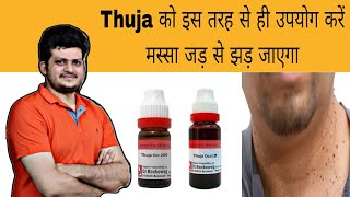 Thuja इस तरह से उपयोग करें मस्सा जड़ से झड़ जाएगा  Warts  Homeopathic Medicine  How to use [upl. by Schreib344]