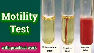 Motility test  Microbiology Microbial Biochemical test [upl. by Ezana]