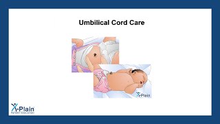 Umbilical Cord Care [upl. by Udale306]