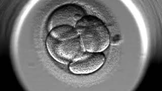 IVF Gynem Klinik  EmbryoScope  Entwicklung des Embryos [upl. by Aisha]