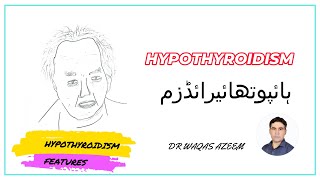 HYPOTHYROIDISM FEATURES [upl. by Zzahc]