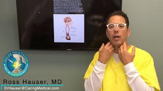 Vision problems from vagus nerve injury and cervical instability [upl. by Yanffit]