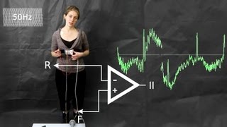 ECG common artefacts and how to avoid them [upl. by Enida]