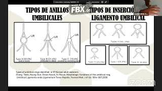 Anatomia pelvica laparoscopia aplicada a la cirugía [upl. by Buford]