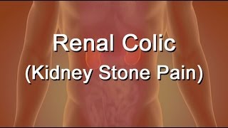 Renal Colic Or Kidney Stone Pain [upl. by Stovall146]