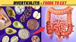 What are the best foods for diverticulitis  Diverticulitis Diet Plan [upl. by Eulalie]