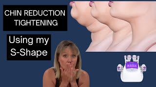 NON Surgical CHIN REDUCTION non Surgical neck lift using my S Shape [upl. by Egan364]