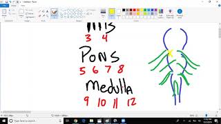 CNS Strokes Made Easy The basics [upl. by Taft]