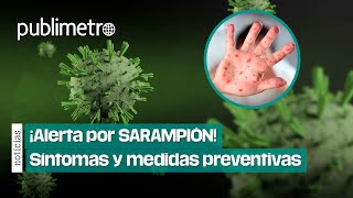 ¡Alerta por SARAMPIÓN Secretaría de Salud pide completar esquemas de vacunación [upl. by Nieberg]