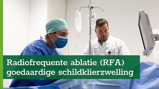 Radiofrequente ablatie RFA bij goedaardige schildklierzwelling [upl. by Relyuc]