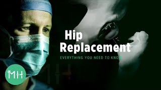 Hip Replacement  Everything you need to know [upl. by Adnaw706]