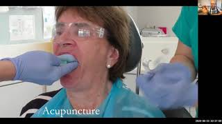 Severe gag reflex  impression making using acupuncture and restoring with a window denture [upl. by Warde]