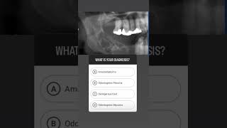 Neetmdspreparation  Ameloblastoma  Oral Path  Mcqs  IBQs Read the description dentalexams [upl. by Giuditta689]