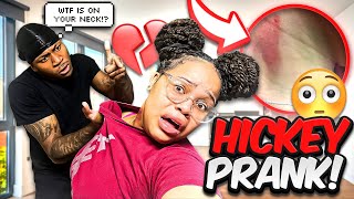 HICKEY PRANK ON BOYFRIEND ALMOST DIED  😵 [upl. by Marquet]