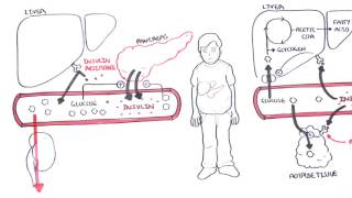 Diabetes Type II Pathophysiology [upl. by Adkins]