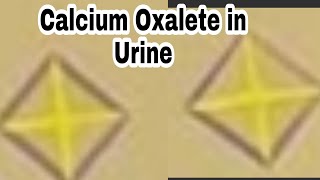 Calcium Oxalate Crystals in Urine  Why and How to Identify [upl. by Etteniotna248]