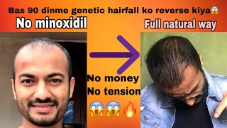 Genetic hairloss natural treatment😱 Mene yeh tarika apnaya😱🔥 ek bhi paisa kharch nahi huwa [upl. by Moulton]