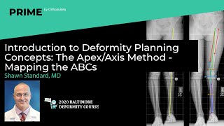 Introduction to Deformity Planning Concepts The ApexAxis Method  Shawn Standard MD [upl. by Alberic665]