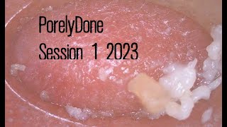 PorelyDone 2023week1 Pore Blackhead and Oil Vacuum Suction Removal [upl. by Kataway]