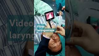 Video laryngoscope Procedure I love India hospital and all peoples ultrasoundcentre lithotripsy [upl. by Immij]