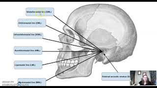 ARRT procedures part 2 Head [upl. by Adnowat]