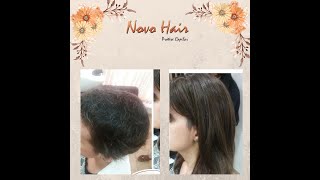 Mega Hair para quimioterapia [upl. by Launamme]