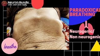 Paradoxical breathing pattern  Diaphragmatic paradox paradoxicalrespiration diaphragmaticpalsy [upl. by Swain835]