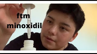 minoxidil trans ftm [upl. by Yvette]