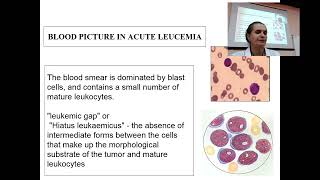 About Leucaemia in 6 minutes from prof Maksimovich Nataliya [upl. by Nodnerb]