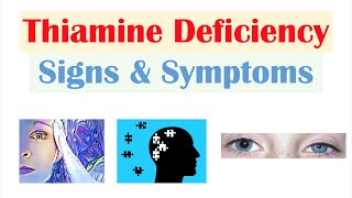 Thiamine Vit B1 Deficiency Signs amp Symptoms amp Why They Occur [upl. by Almat]