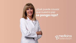 🔴 URTICARIA  Que es Sintomas y tratamiento drapilarochoa  Dermatologa [upl. by Corder]